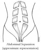 Getting rid of the mommy pooch with transverse abdominal workout ...