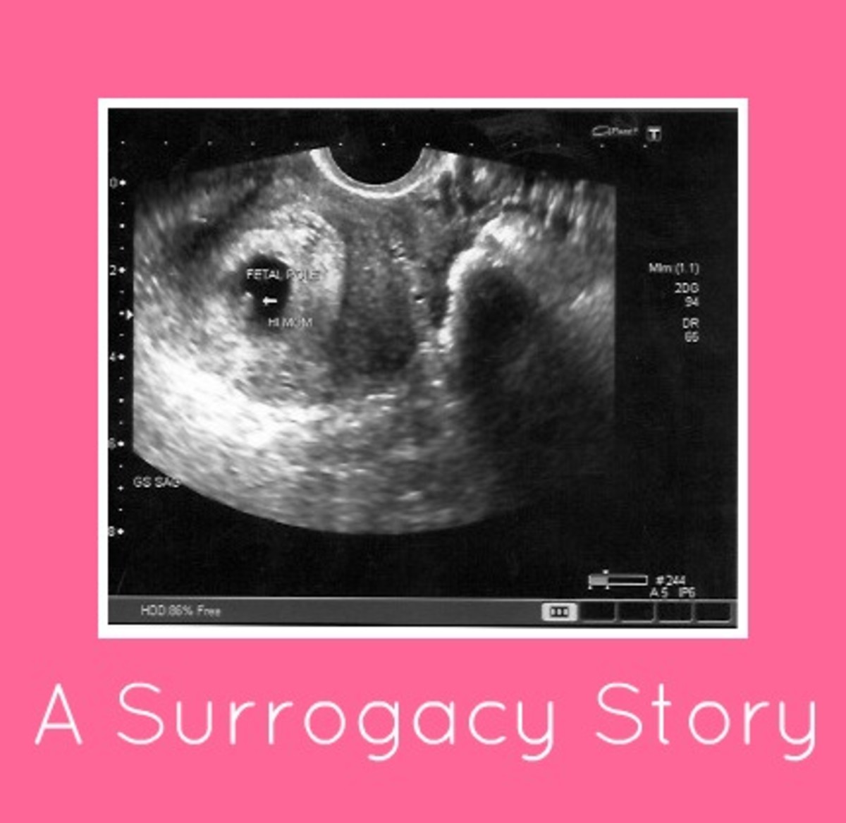 Surrogacy Story