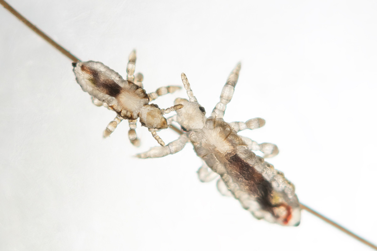 Head Lice Prevention - TodaysMama - Today's Mama